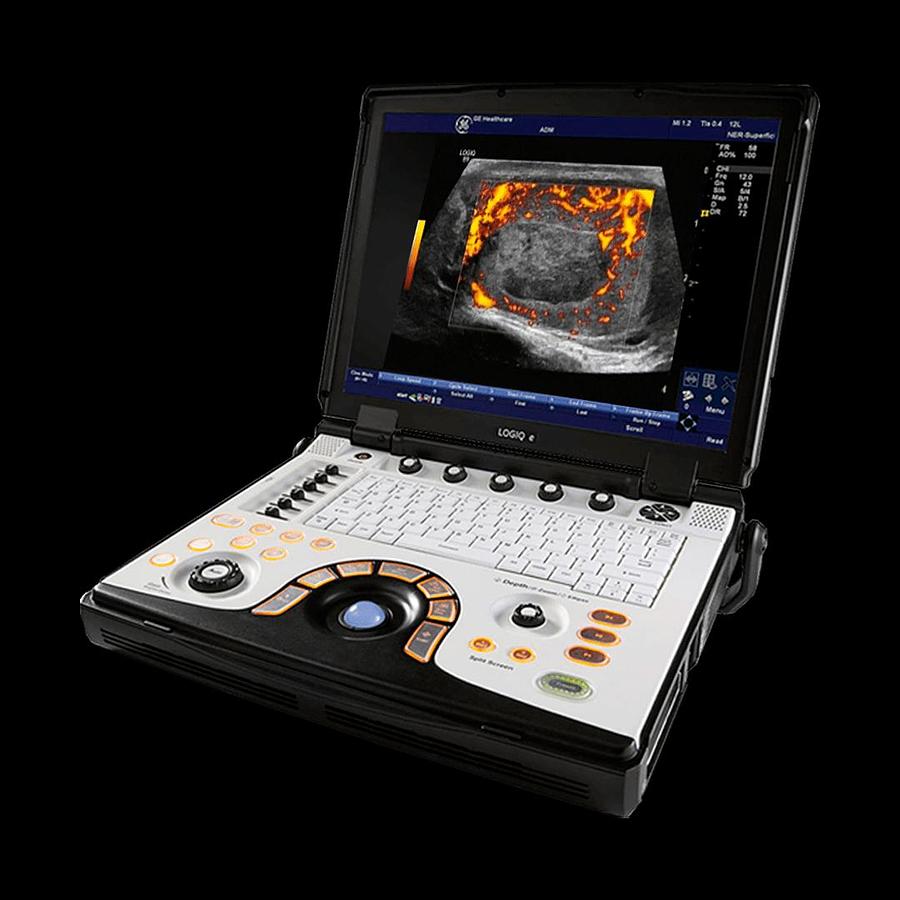 Refurbished Ultrasonido portátil General Electric (GE) LOGIQ e