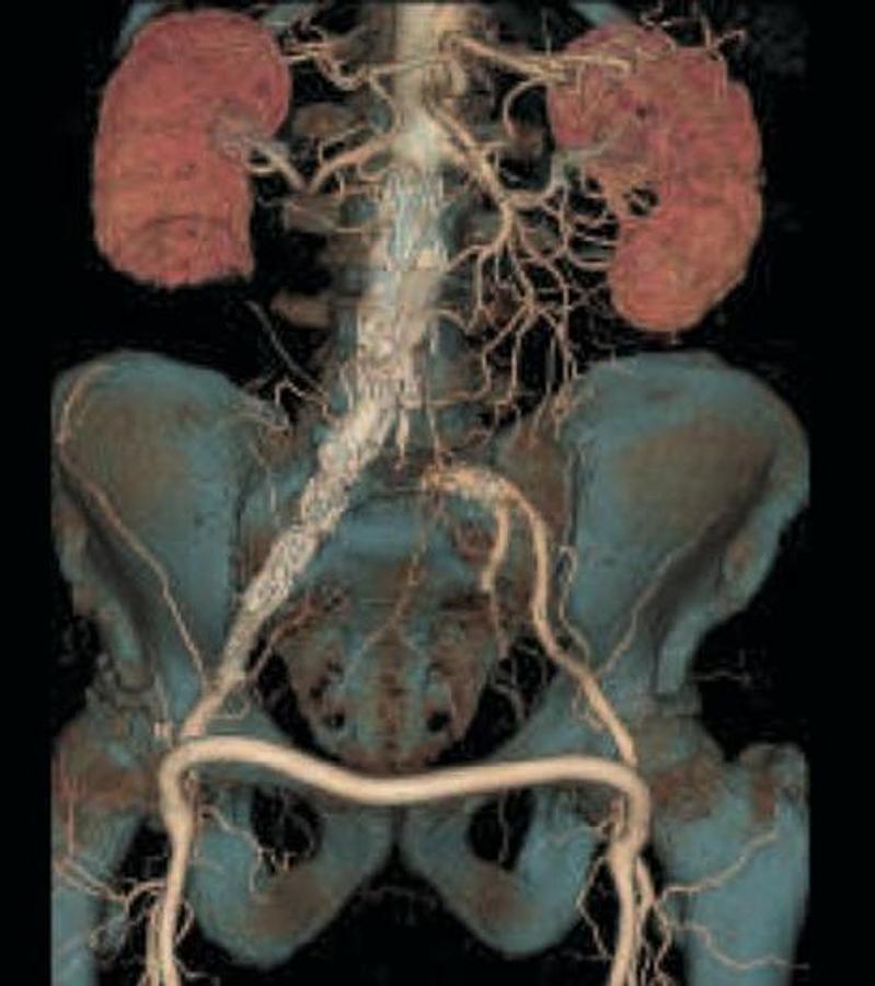 Refurbished General Electric (GE) LightSpeed VCT