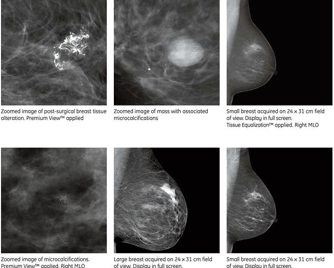 Used Mastógrafo  Digital GE Essential