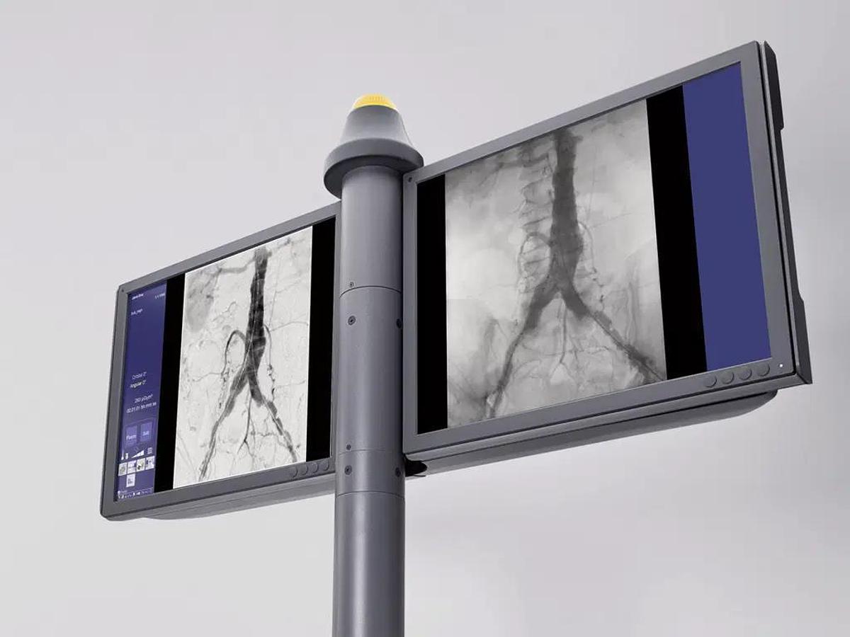 Usado Arco en C SIEMENS Cios Alpha