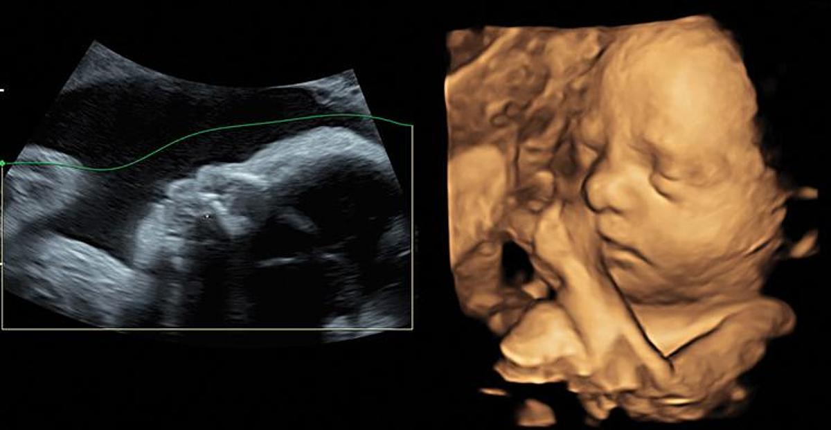 Reformado Ultrasonido GE Voluson S6 BT12