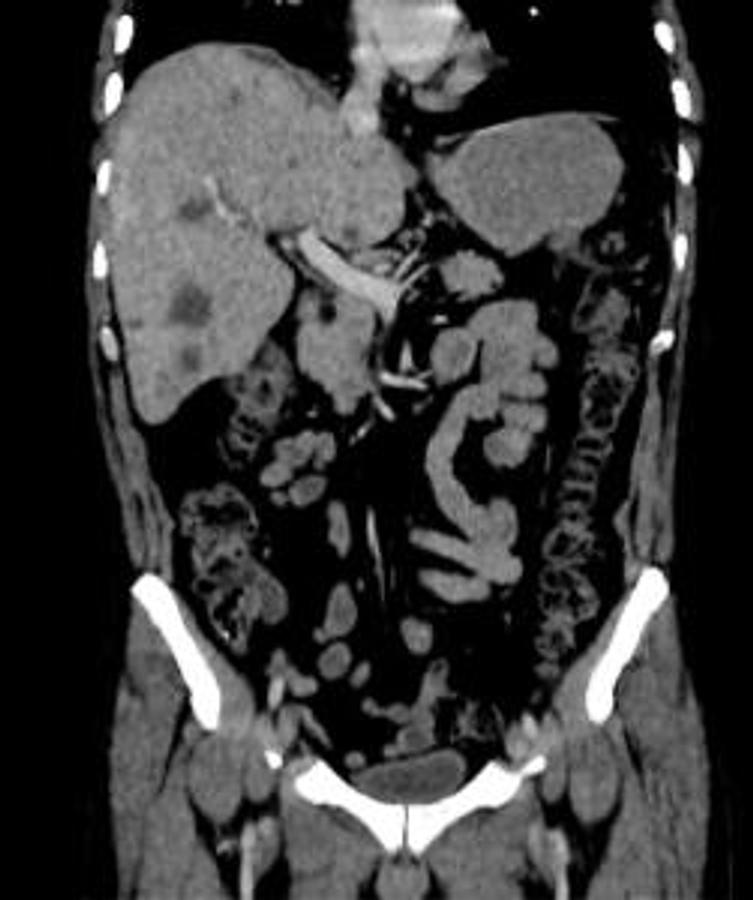Refurbished Tomógrafo GE (General Electric) BrightSpeed Elite de 16 cortes