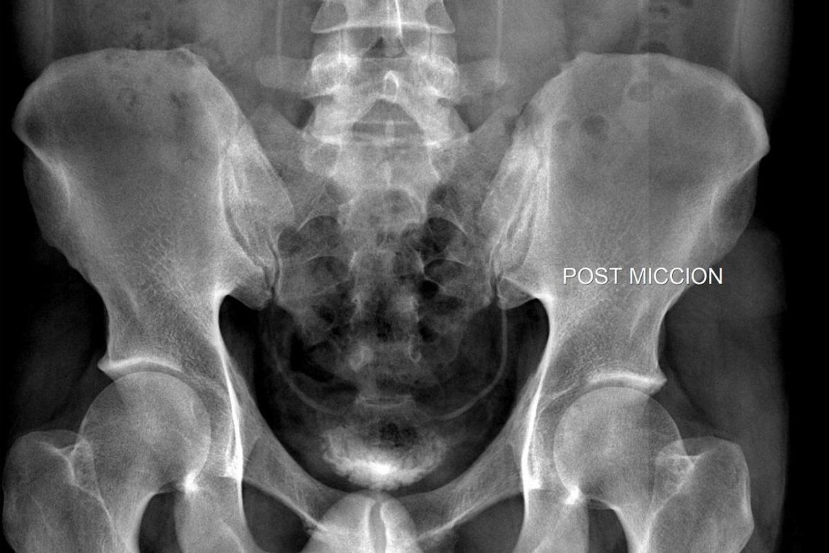 Flat Panel iRay Mars 1417V