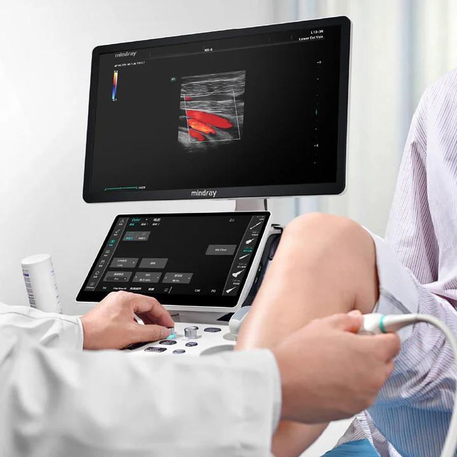 Ultrasonido Mindray Consona N6