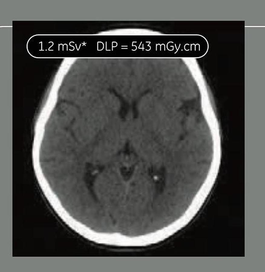 Reformado Tomografo Optima 660 GE (General Electric) 64 cortes