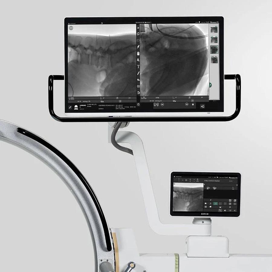 Arco en C Quirúrgico Fujifilm Persona CS (Nuevo | Compacto 5kW Flat Panel)