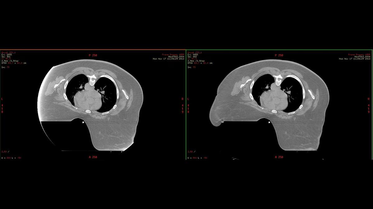 Refurbished Tomografo General Electric (GE) Discovery CT590 RT