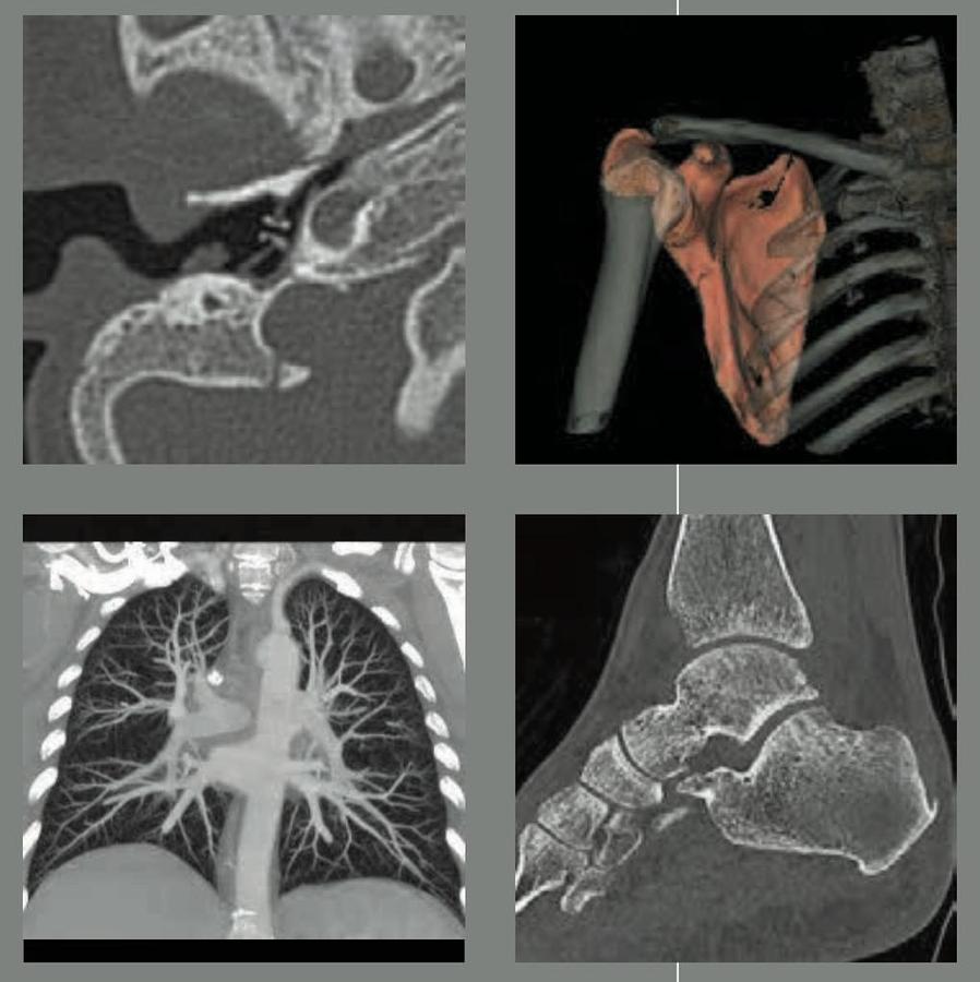 Reformado Tomografo General Electric Optima 660 de 64 cortes