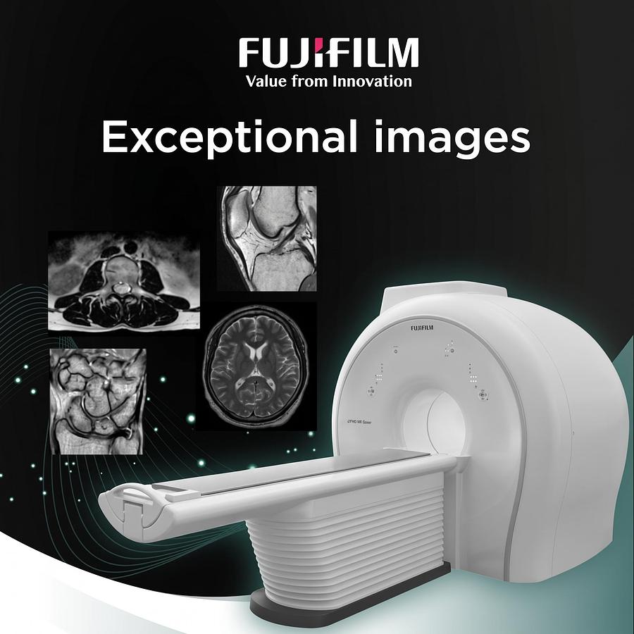 Resonancia Magnética Fujifilm Echelon Smart 1.5T (Nuevo)