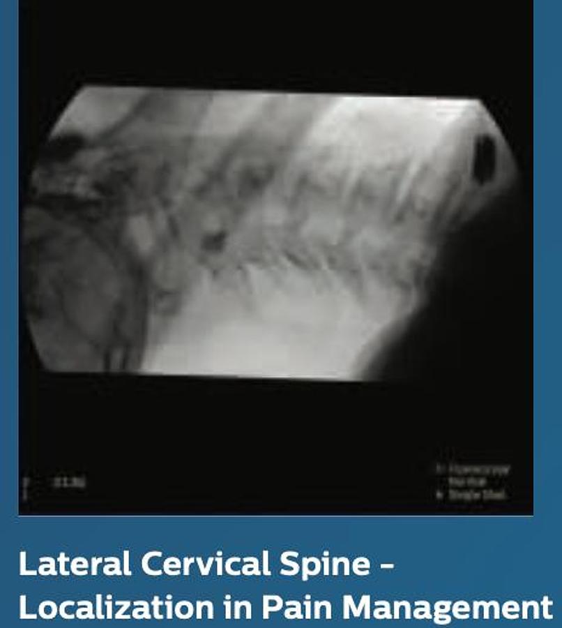 Usado Philips Veradius Unity