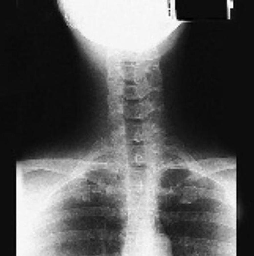 Usado 2001 General Electric (GE) Proteus Xr/a