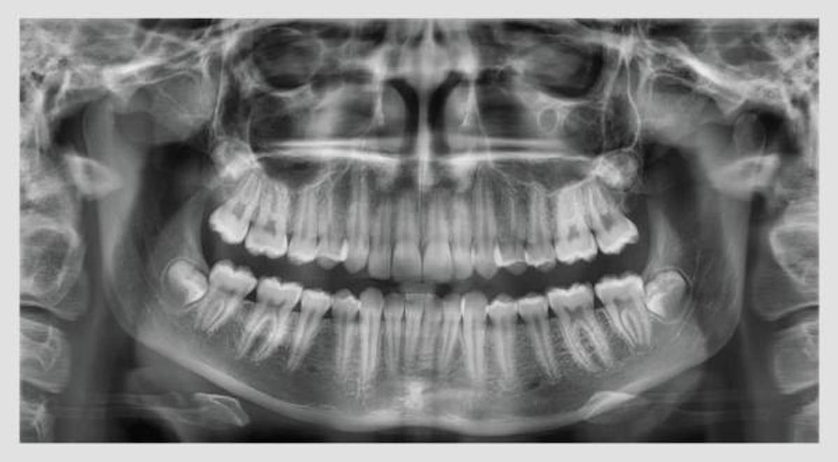 Rayos X Dental Panorámico y Digital PaX-i Vatech