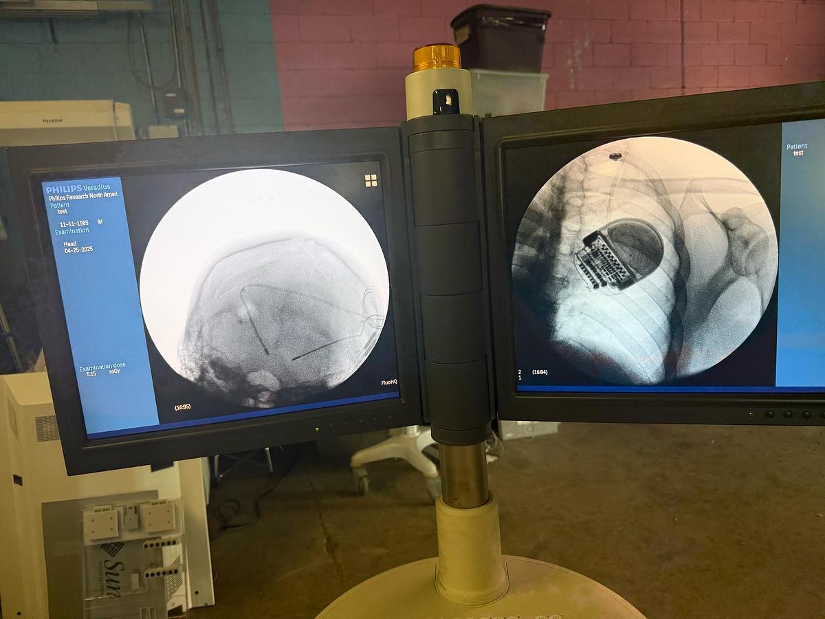 Usado Arco en C Philips Veradius