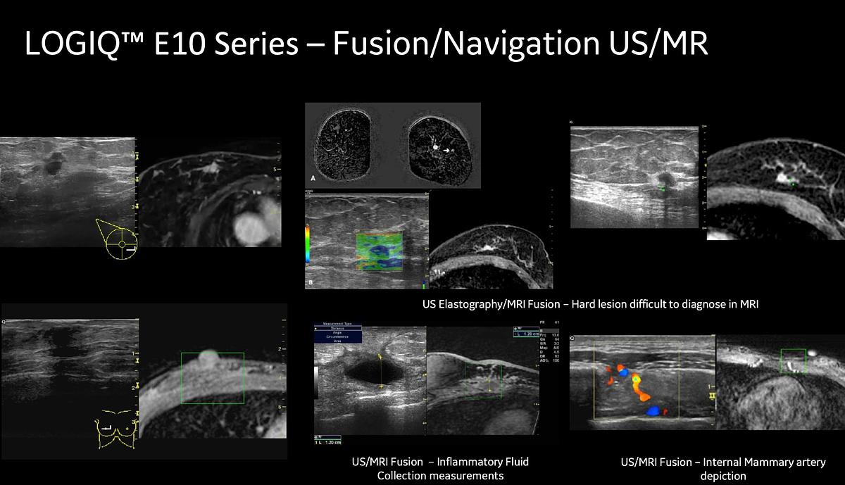 Refurbished 2025 General Electric (GE) LOGIQ E10