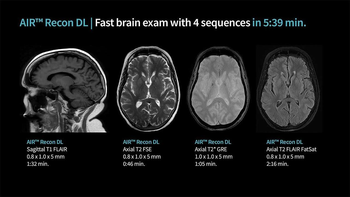 Refurbished 2019 General Electric (GE) Signa Explorer 1.5T