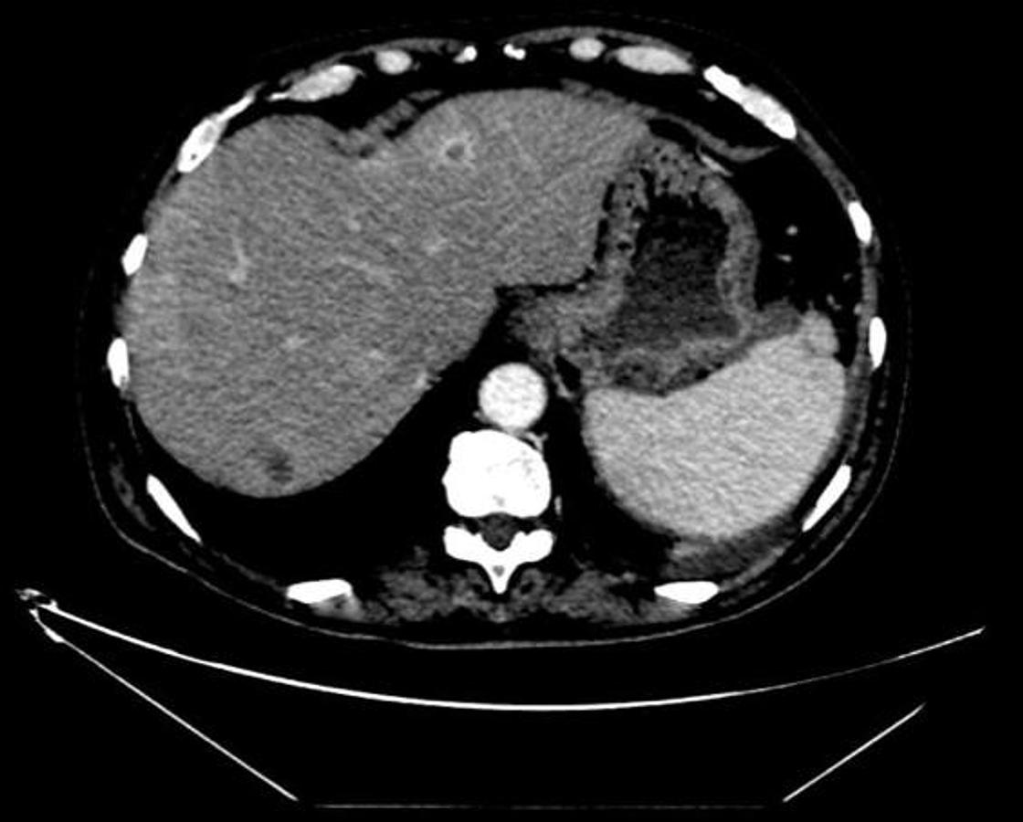 Refurbished Tomógrafo GE (General Electric) BrightSpeed Elite de 16 cortes