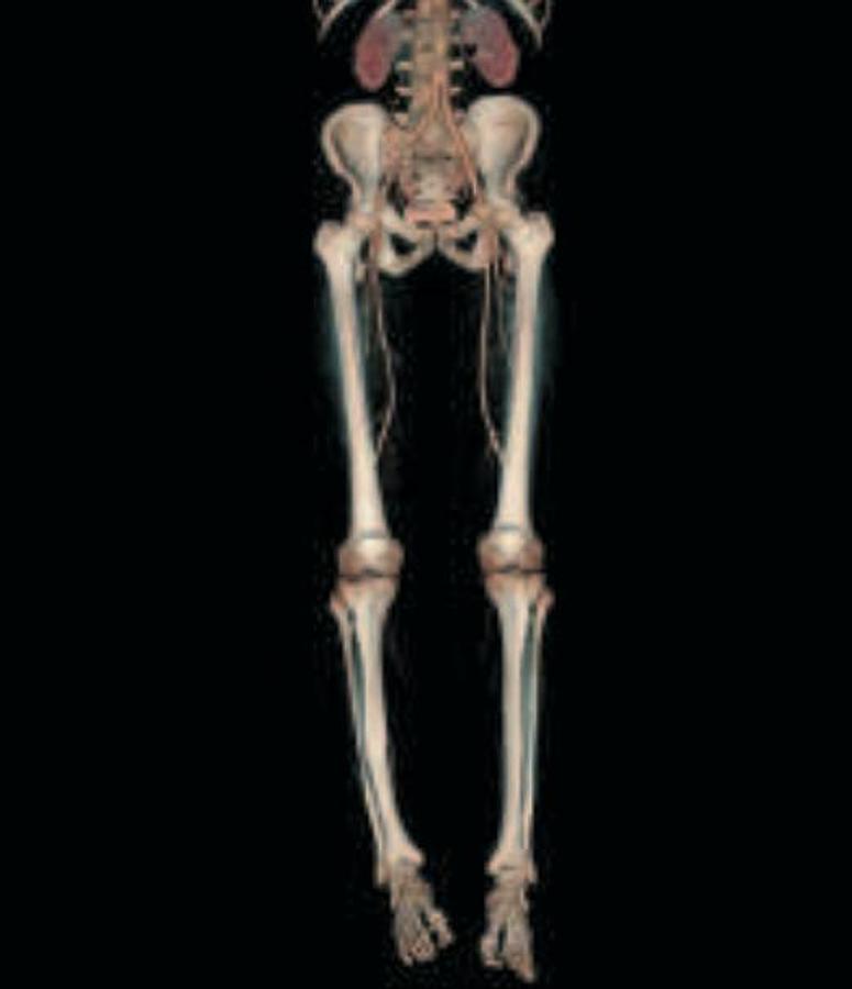 Refurbished General Electric (GE) LightSpeed VCT