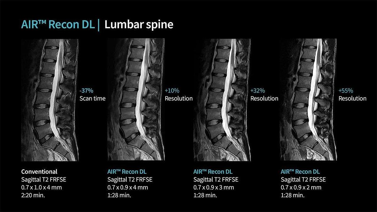 Refurbished 2019 General Electric (GE) Signa Explorer 1.5T
