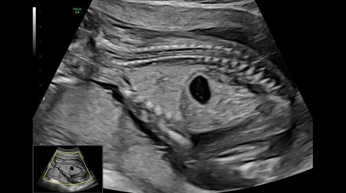 Refurbished 2026 General Electric (GE) Voluson E8