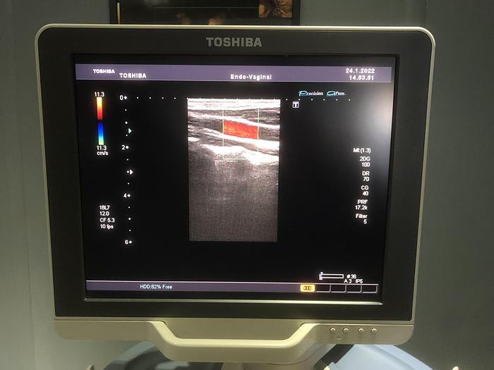 Gebraucht TOSHIPA-Xario-Ultraschallgerät-5046