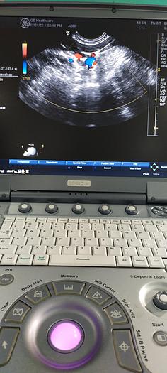 Gebraucht GE E8C-RS Transvaginal Ultraschallsonde