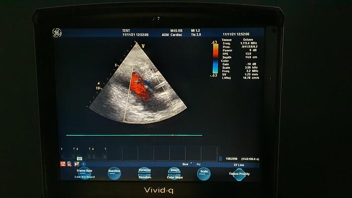 Gebraucht GE Vivid Q Ultraschallgerät
