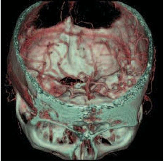 Reformado 2005 General Electric (GE) LightSpeed VCT