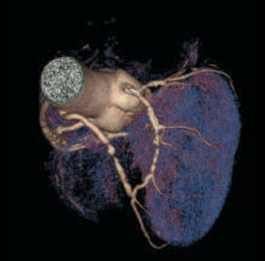 Reformado 2005 General Electric (GE) LightSpeed VCT