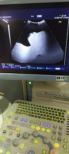 Gebraucht Hitachi 5- konvex Ultraschallsonde