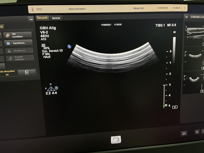 Gebraucht Philips Affiniti 50G Ultraschallgerät mit Sony Drucker