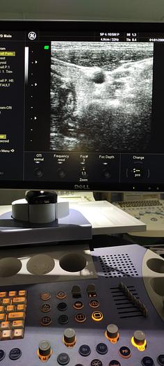 Gebraucht GE SP4-10 Linear Ultraschallsonde