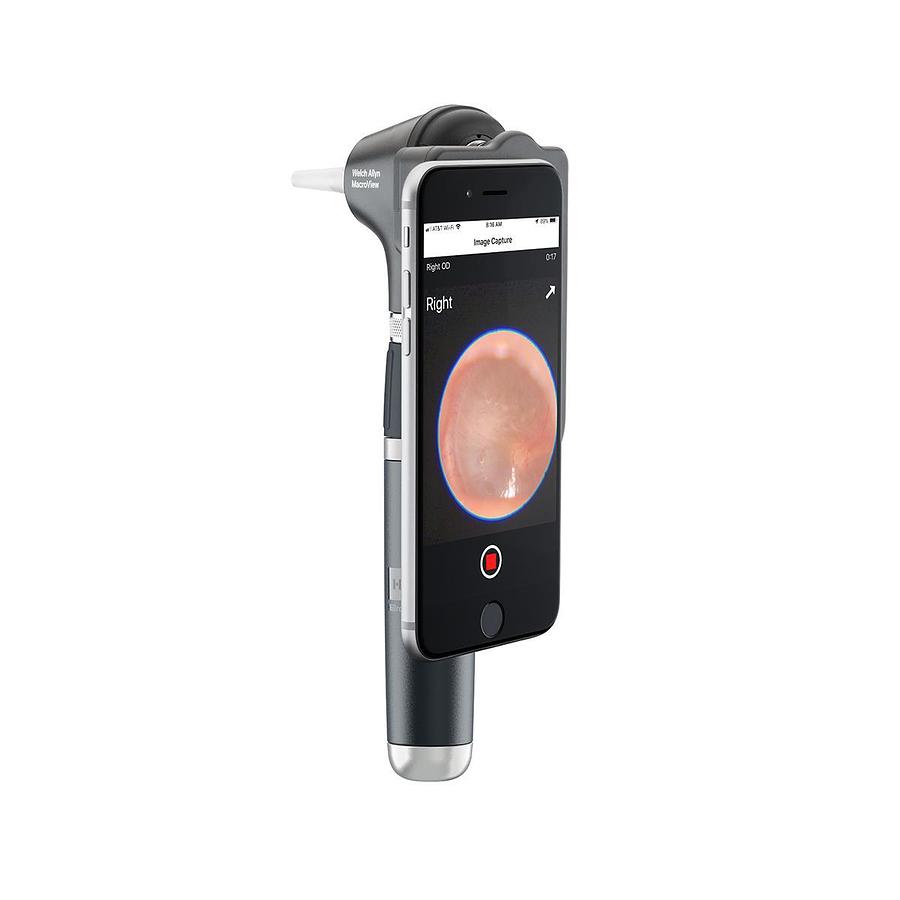 Used Welch Allyn MacroView Plus Otoscope