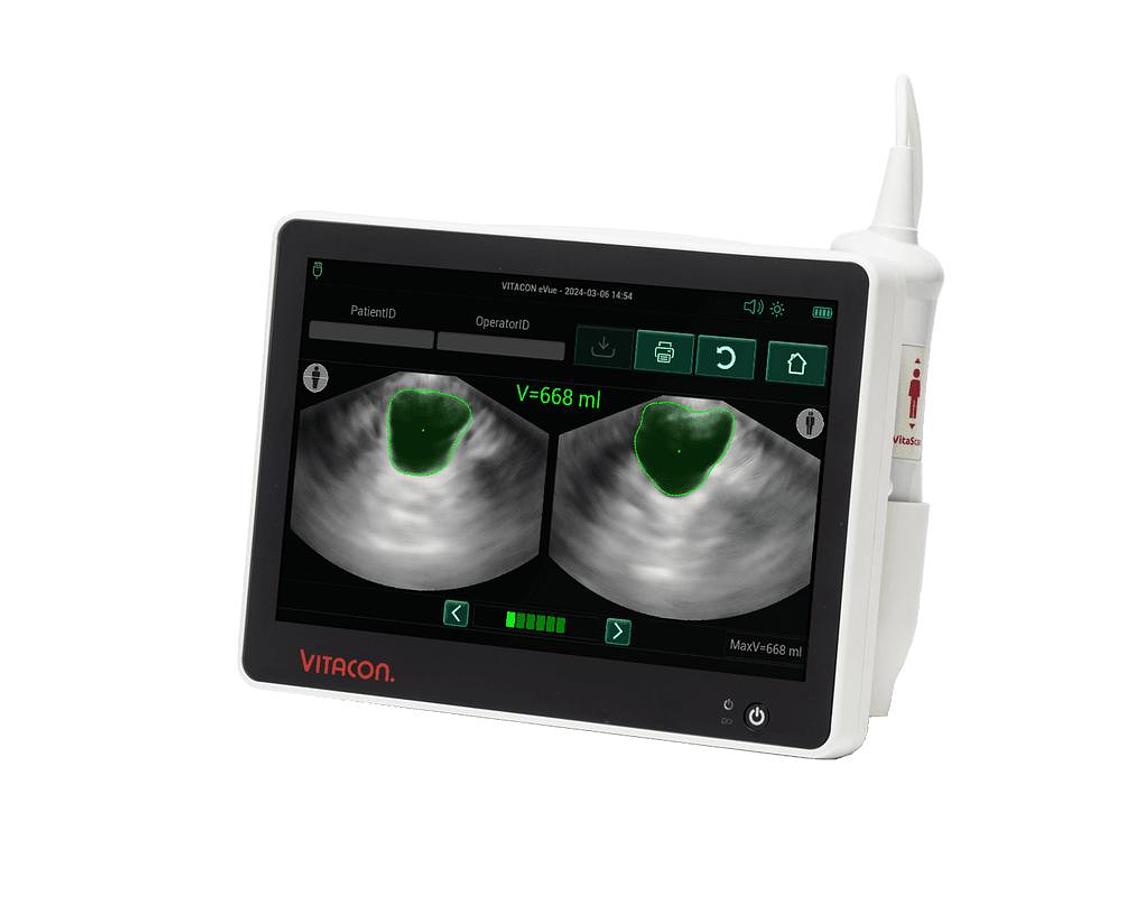Used Vitacon eVue Bladder Scanner