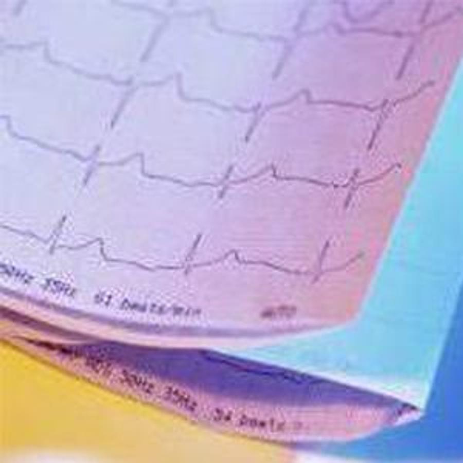 Used Welch Allyn ECG Paper for CP 100/CP 200