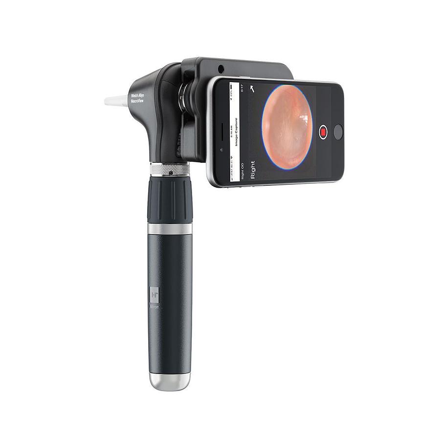 Used Welch Allyn MacroView Plus Otoscope