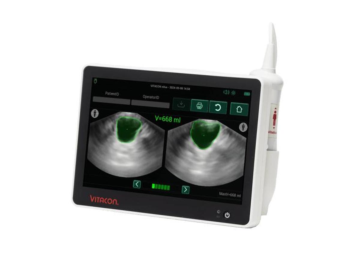Used Vitacon eVue Bladder Scanner