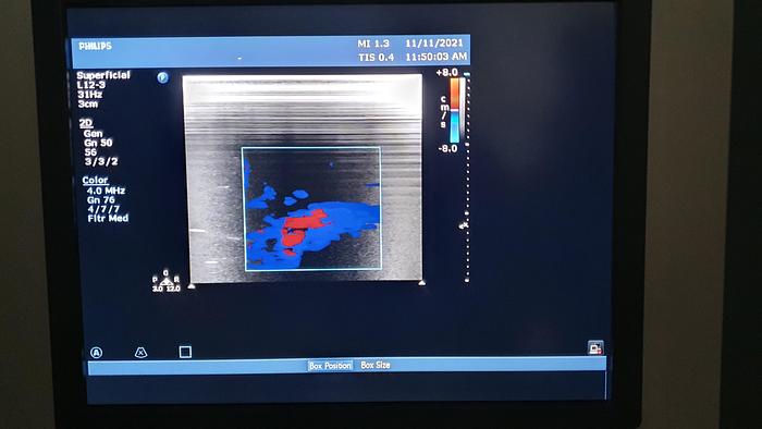 Gebraucht Philips HD15 US91120069