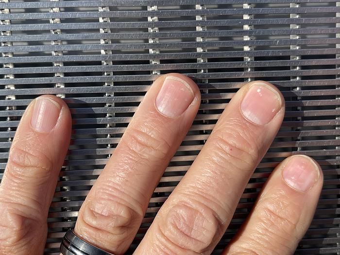 Used 60" Lyco Stationary Dewatering Screen