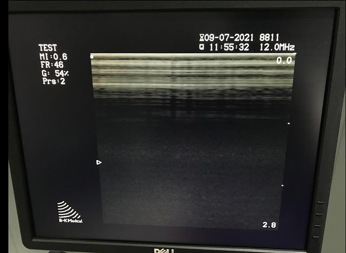 Gebraucht BK Medical 2101 Falcon Ultraschallgerät mit 3 Sonden und Sony Drucker