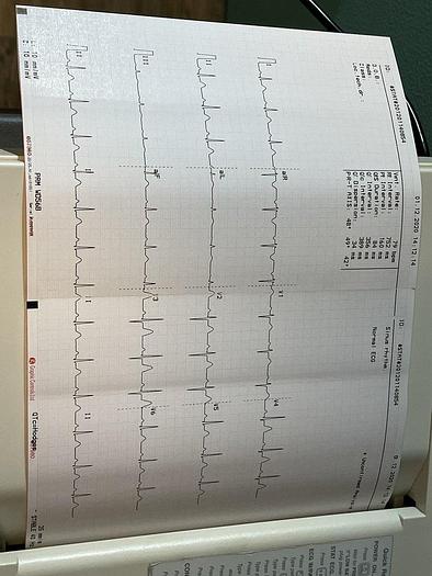 Used Spacelabs Burdick Eclipse 850 EKG Gerät auf Trolley mit EKG Kabel