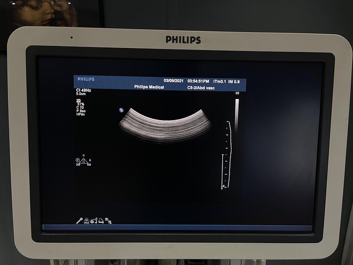 Gebraucht Philips IE33 Ultraschallgerät mit 4 Ultraschallsonden, Sony Drucker