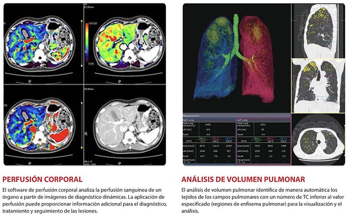 Used 2015 Toshiba Aquilion Prime