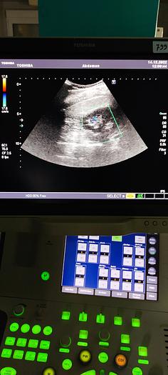 Gebraucht Toshiba PVT-375 Konvex Ultraschallsonde