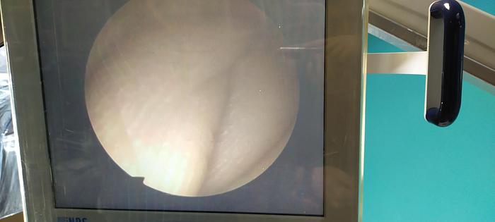 Gebraucht World of Medicine / Lemke Endoskopie Turm mit Zubehör