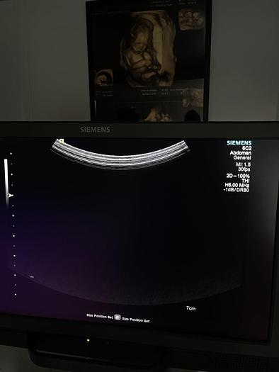 Gebraucht Siemens Acuson S1000 Ultraschallgerät mit Konvex-Sonde und Mitsubishi P95 Drucker