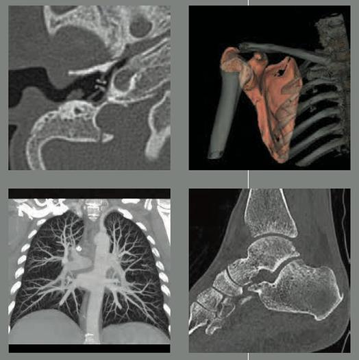 Used 2018 General Electric (GE) Optima CT660