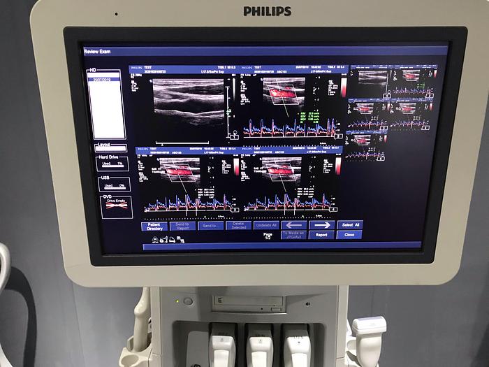 Gebraucht Philips iU22 Ultraschallgerät mit Flachmonitor, 2 Sonden, Sony Drucker