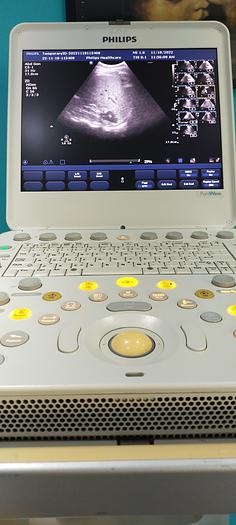 Gebraucht Philips CX50 tragbare Ultraschallgerät auf Philips CX Wagen inkl. Netzteil
