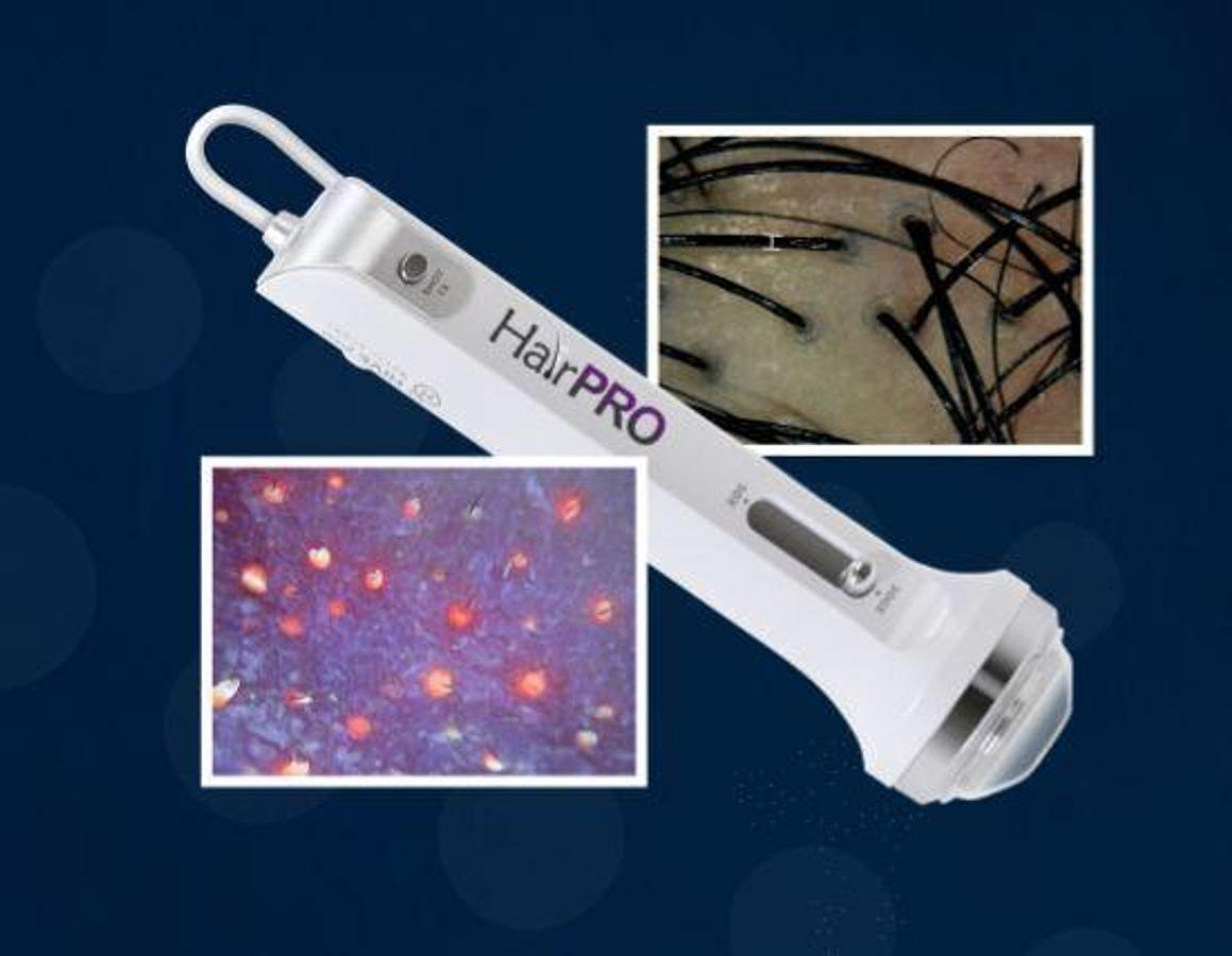 For Sale EMAGE Medical Image PRO HairPRO