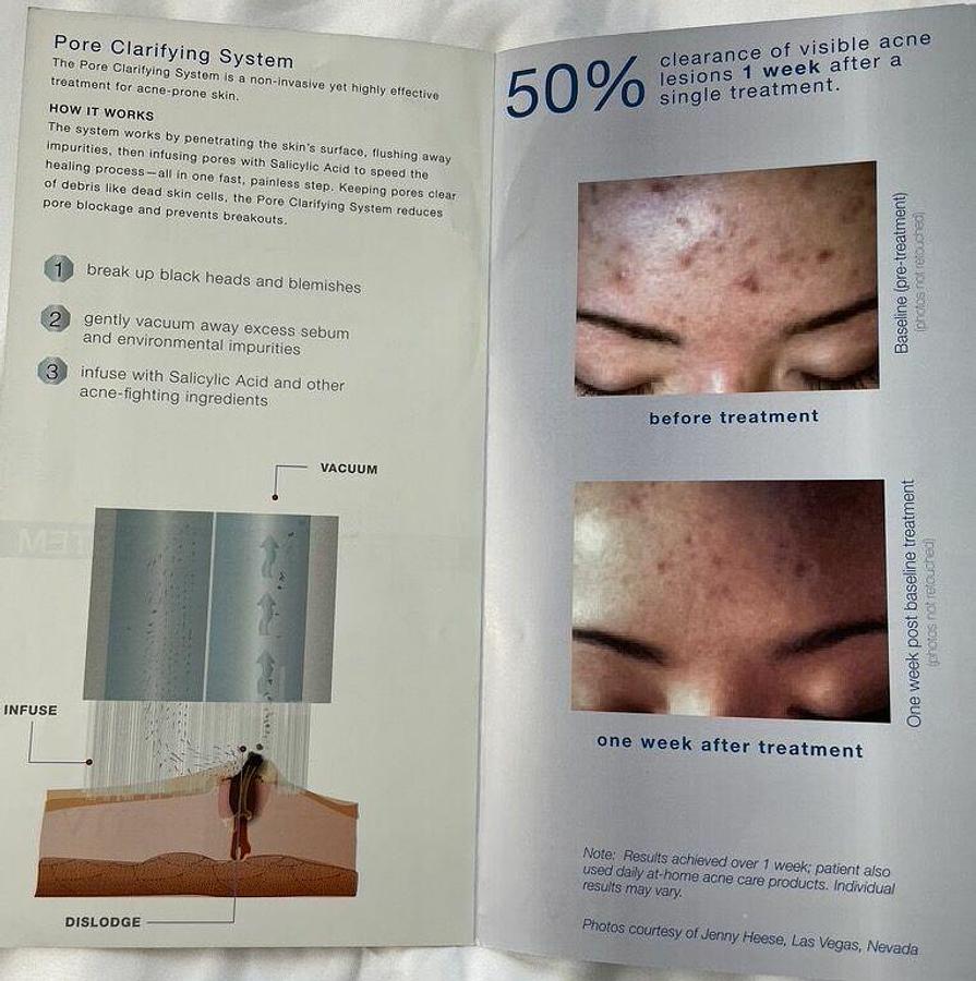 Used For Sale ENVY Pore Clarifying Hand Piece Microdermabraders